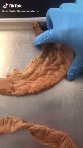 Understanding Migrating Motor Complex in Human Biology