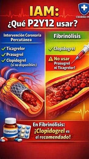 ¿Así se usan en IMA los P2Y12?#Shorts