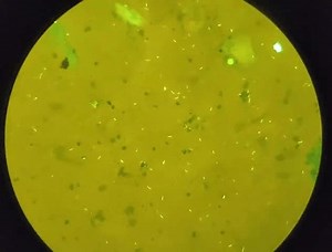 3 Acid Fast Bacterium Stock Video Footage - 4K and HD Video Clips | Shutterstock