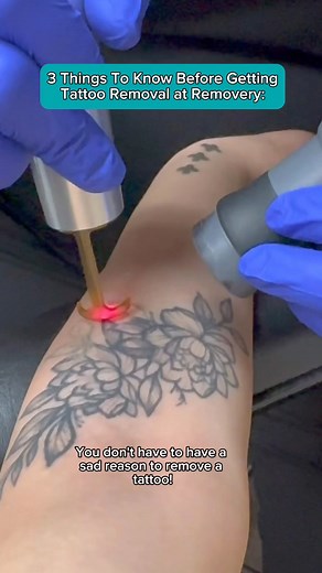 3 things to know before getting tattoo removal at Removery!💡 We're here to make your tattoo removal journey as easy and enjoyable as possible - no matter what you're getting removed🫶 Start today and rediscover the joy of being you! Find a studio near you using the link in our bio! 🔗 | Removery