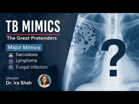 TB Mimics: The Great Pretender | By Dr. Ira Shah