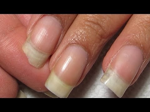 How to Fix a Broken Corner | DIY Nail RepairTutorial