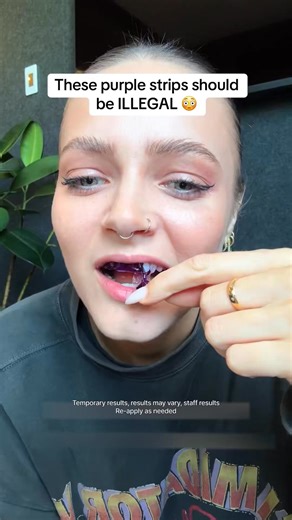 😃 Hismile V34 Teeth Whitening Strips – Whitening Reinvented ✨ Forget painful peroxide whitening — meet the future of a brighter smile! Powered by V34 colour correction PAP technology, these strips lift stains and neutralize yellow tones without sensitivity. ✅ Instant Results – Violet pigments balance yellow for a visibly brighter smile after just 1 use. ✅ Dual Whitening Power – PAP removes stains, V34 enhances brilliance. ✅ 30-Minute Routine – Stick. Wait. Peel. Brush. Done. Easy & mess-free. ✅