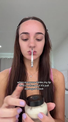 Understanding Lip Dents: What You Need to Know