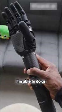 The Future of Prosthetics in 2025 – Tech That Feels Like Sci-Fi