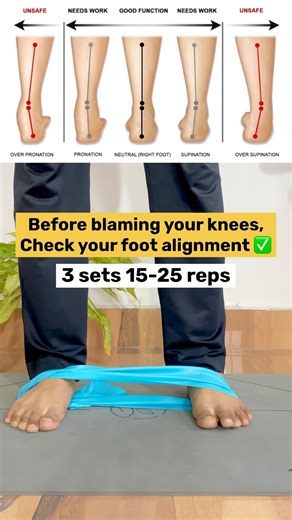 Knee Pain Ka Asli Reason? Check Your Foot Alignment