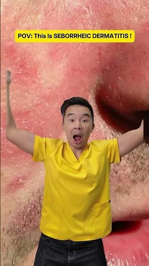 This is seborrheic dermatitis , not acne or irritation