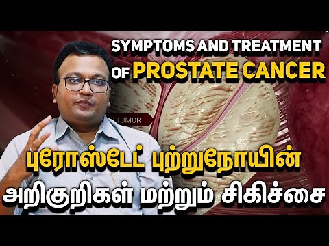 Prostate Cancer: Symptoms & Breakthrough Treatments | Onco Doctor Tamil Dr. Dayananda Srinivasan