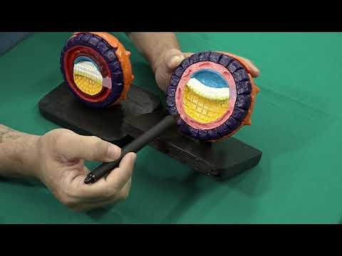 Formação do Mesoderma Extra-embrionário