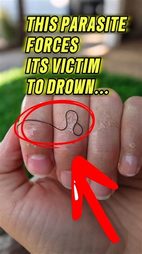 This Parasite Forces Its Victim to Drown… #animalfacts #animals #wildanimals