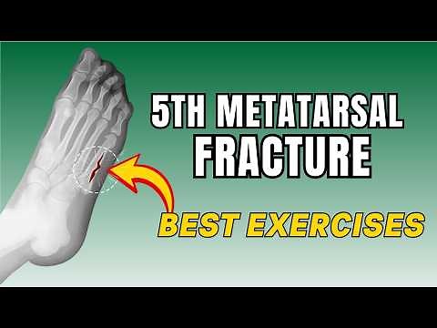 5th Metatarsal Fracture Exercises | Jones Fracture Rehab Exercises | Foot Fracture Physical Therapy