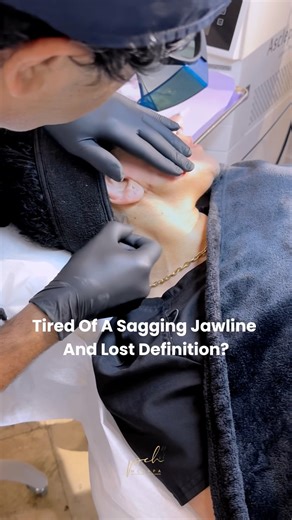 I Tried The New Laser Face Treatment Everyone's Raving About