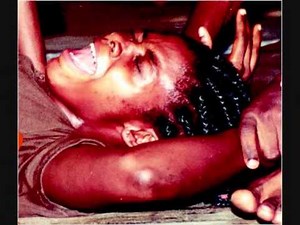 weibliche Beschneidung