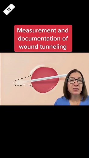 Wound tunneling: Wound Care SHORT | ‪@LevelUpRN‬