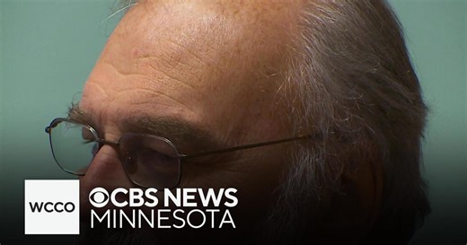 What makes hair turn gray? When does it typically start?