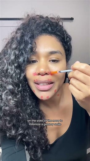 Areas you can treat Botox below the eyes 👀 #botox #botoxnatural #wrinkles #antiaging