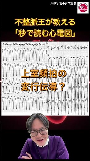 【不整脈医が教える「秒で読む心電図」】
