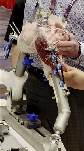 You can do this with a synthetic model?!