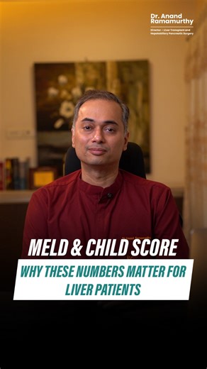 Your liver condition is not assessed by symptoms alone — it is evaluated using scientific scoring systems that help doctors understand how well the liver is functioning. In this video, I explain what MELD and Child–Pugh scores mean, how they help assess disease severity, complication risk, and transplant priority, and why regular monitoring is important for patients living with chronic liver disease. Knowing your score empowers you to take informed and proactive decisions about your health. #Cli
