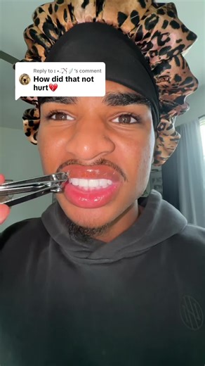 Replying to @ɪ •.🏹🪽 lets see if it hurts | hurt filter injured