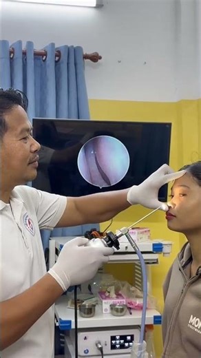 Professional Nose Examination 👃🔍 | ENT Doctor Endoscopic Check #HealthCare #ENT