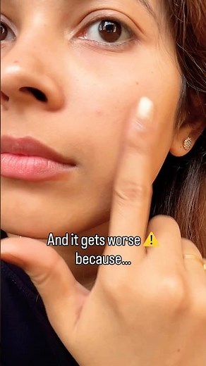 This Pimple Difference Changes Everything ❌