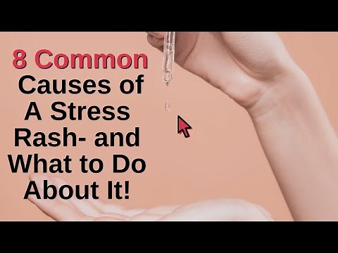 8 Common Causes of a Stress Rash