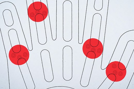 Your Treatment Journey for Moderate to Severe RA