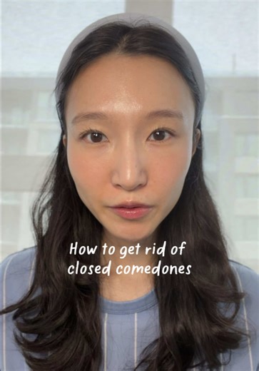 5 tips to get rid of your closed comedones: 1. Identify and remove anything that can clog your pores 2. Double cleanse at night and cleanse thoroughly 3. Exfoliate - BHA is the best at unclogging pores as it can penetrate deeper (good for oily skin). AHA is more surface level and can help smooth texture. LHA is a more gentle derivative of BHA (I like to use this almost daily) & PHA is a more gentle derivative of AHA (best for people with dry skin) 4. Protect and hydrate your barrier - a damaged