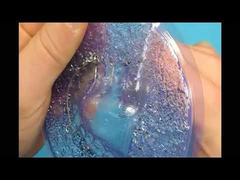 Technique: Fabricating a Hawley Retainer with Anterior Bite Plate