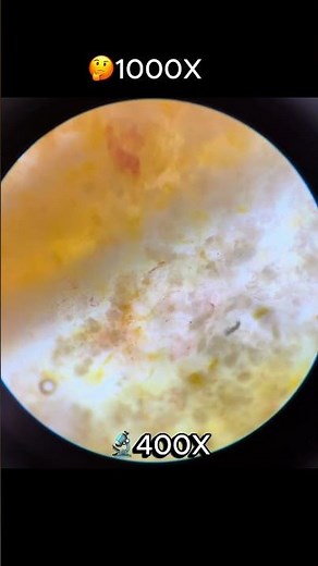 🔬 Tomato Under the Microscope Incredible Close-Up View! 🍅#Microscope #MicroscopicWorld #Science