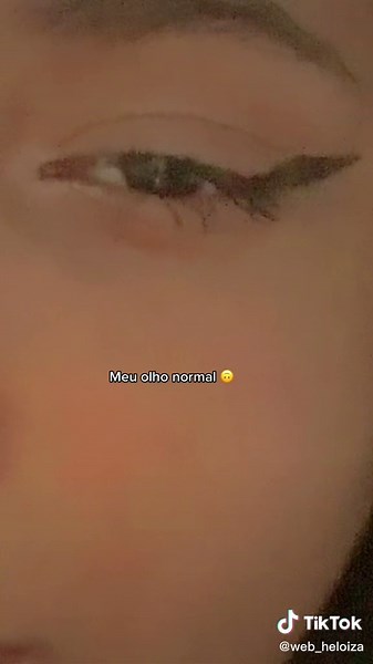 Exploring the Latest Eye Trend on TikTok