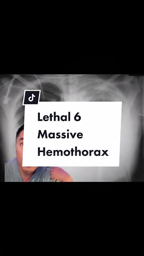 Understanding Hemorrhagic Shock and Auto-Transfusion in Trauma Surgery