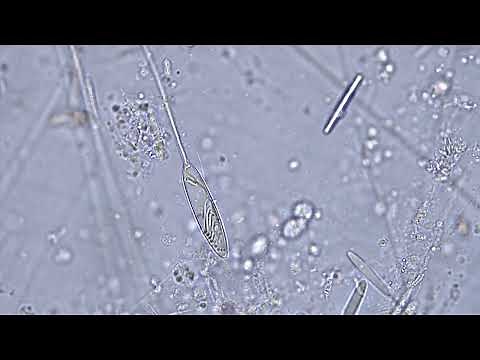 Nematocyst discharge