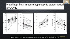 High flow oxygen therapy Acute respiratory failure