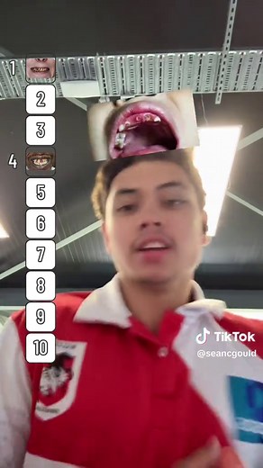 Avoid Treadmill Accidents: Tips for Safe Workouts