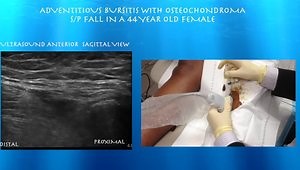 Knee Ultrasound & Cortisone Injections - Case Presentations
