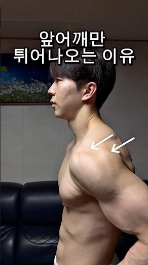 Why Exercise Damages Your Shoulders (Anterior Humeral Glide)