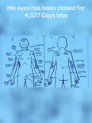 An 8 year old child named “Gabriel Fernandez” from Palmdale,California, who was brutally beaten by his Mother to death on May 22,2013 and was taken to the hospital but after checking he was pronounced dead. RIP Gabriel Fernandez🪦🕊️🕊️🕊️