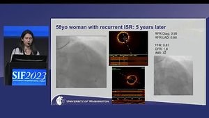 Coroflow Testing: A Comprehensive Physiology Solution