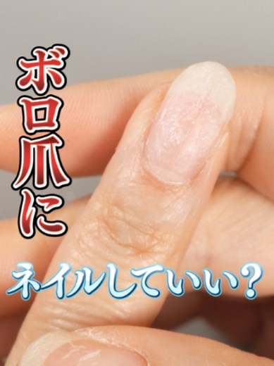ジェルネイルで痛みがある時の対処法と休むべきサイン