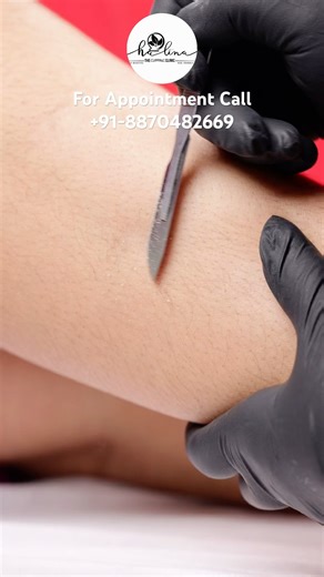 Dermaplaning in Legs 🦵🏽 #shorts #tamil #skincare #trending #youtube #dermaplaning #skin #chennai