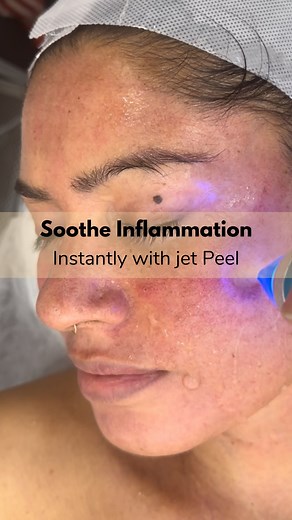 The Bombay Skin Clinic | JET Facial isn’t the treatment — it’s the foundation. At The Bombay Skin Clinic, we never do JET as a standalone. It’s always the first... | Instagram