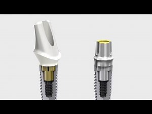 Nobel Biocare Implant Systems