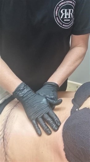 Post surgery Reduce Swelling and Edema. Lymphatic drainage after post-surgery helps to alleviate swelling and edema by promoting the movement of excess fluid build-up. The gentle massage techniques encourage lymph flow, facilitating the body's natural drainage process and leading to quicker recovery. Accelerate Healing. By improving lymphatic circulation, the body's immune system is boosted, which aids in removing toxins and cellular waste from the surgical site. This accelerated healing process