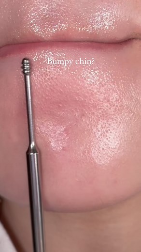 210K views · 7.1K reactions | Whats In my skincare kit always…  -Celimax BHA peeling pads -HEVEBLUE Auto Eye Cream -Skin1004 Poremizing Cleanser -Celimax Retinal Booster -Kopher SOS System Video @misspeytonsmith 懶 #kbeauty #koreanskincare #koreanbeauty #texturedskin #acne #beauty #asianbeauty #glowy #skincare101 #bumpyskin #bha | Song Of Skin | Facebook