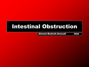 Intestinal Obstruction - SlideServe
