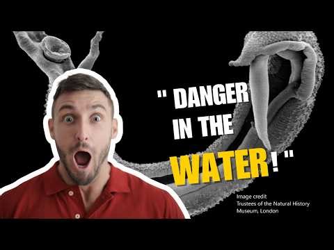 Schistosomiasis: The Disease That Enters Your Body Just By Walking in Water