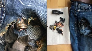 Terrence Johnson describes what happened after his e-cigarette battery caught fire in his pant pocket