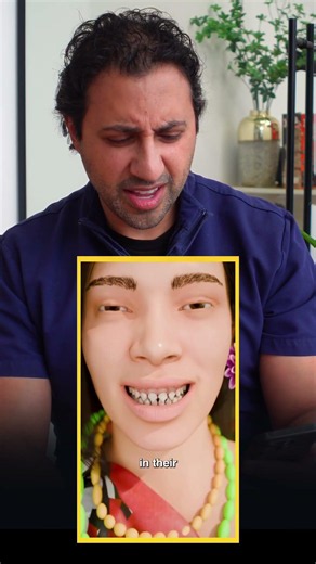 I prefer straight teeth... 🦷